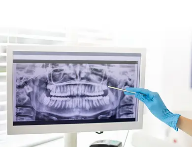 Imágenes Odontológicas