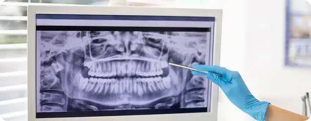 Imágenes Odontológicas